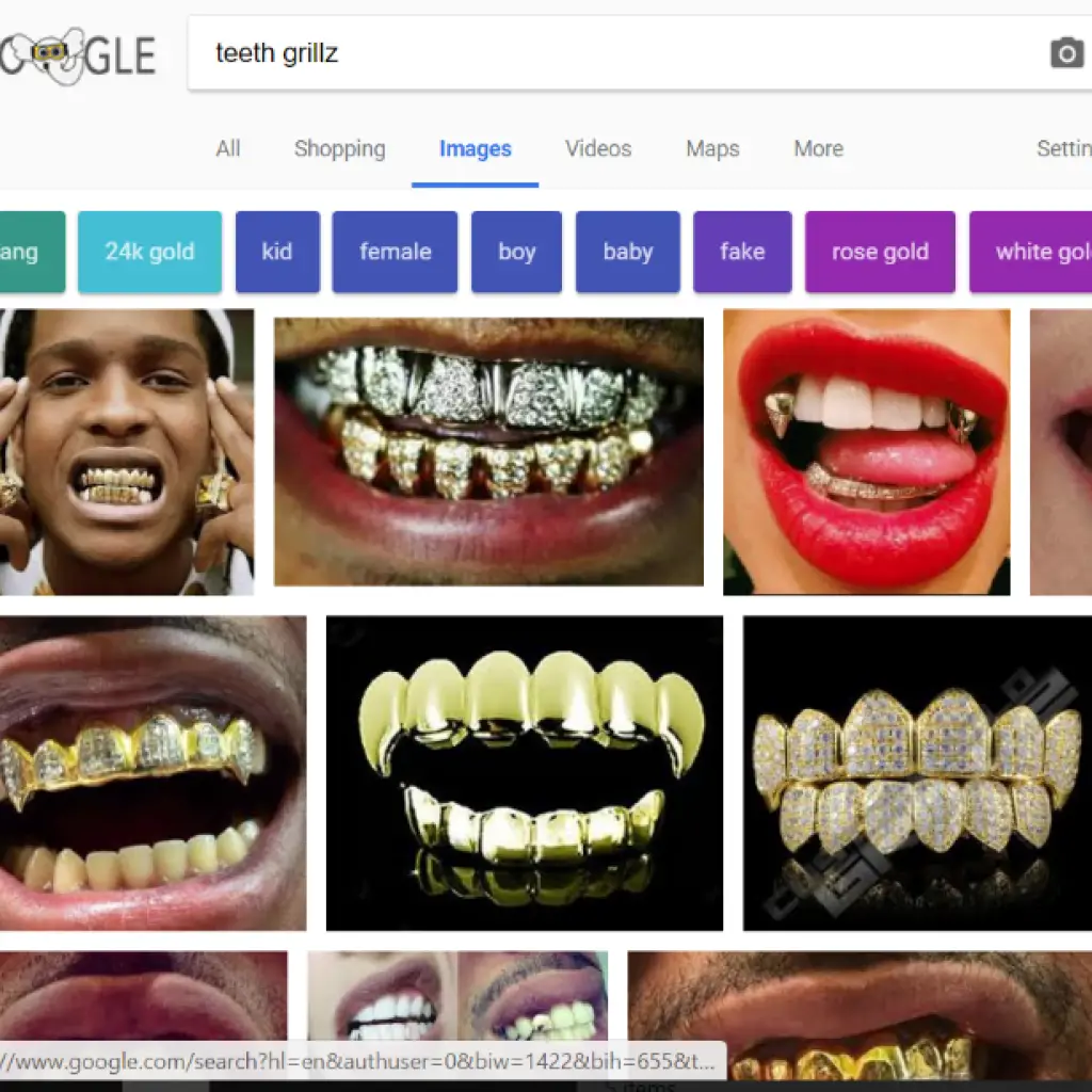 How Much Does A Grill Cost For Your Teeth